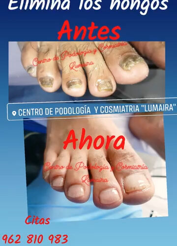 Aviso