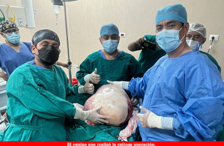 Extirpan tumor gigante a mujer